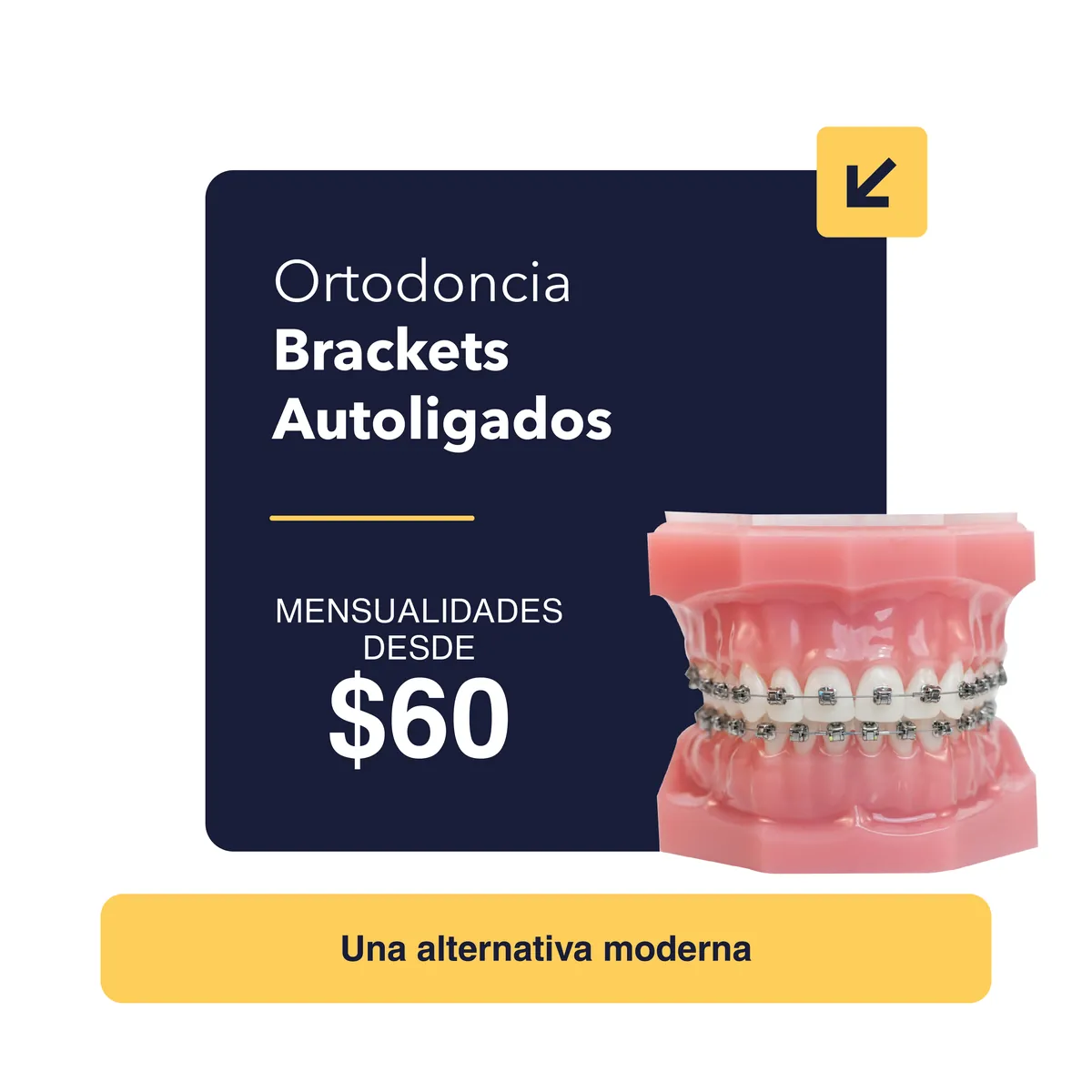Promoción Ortodoncia Brackets Autoligados desde $60 - Red Bucal Colón